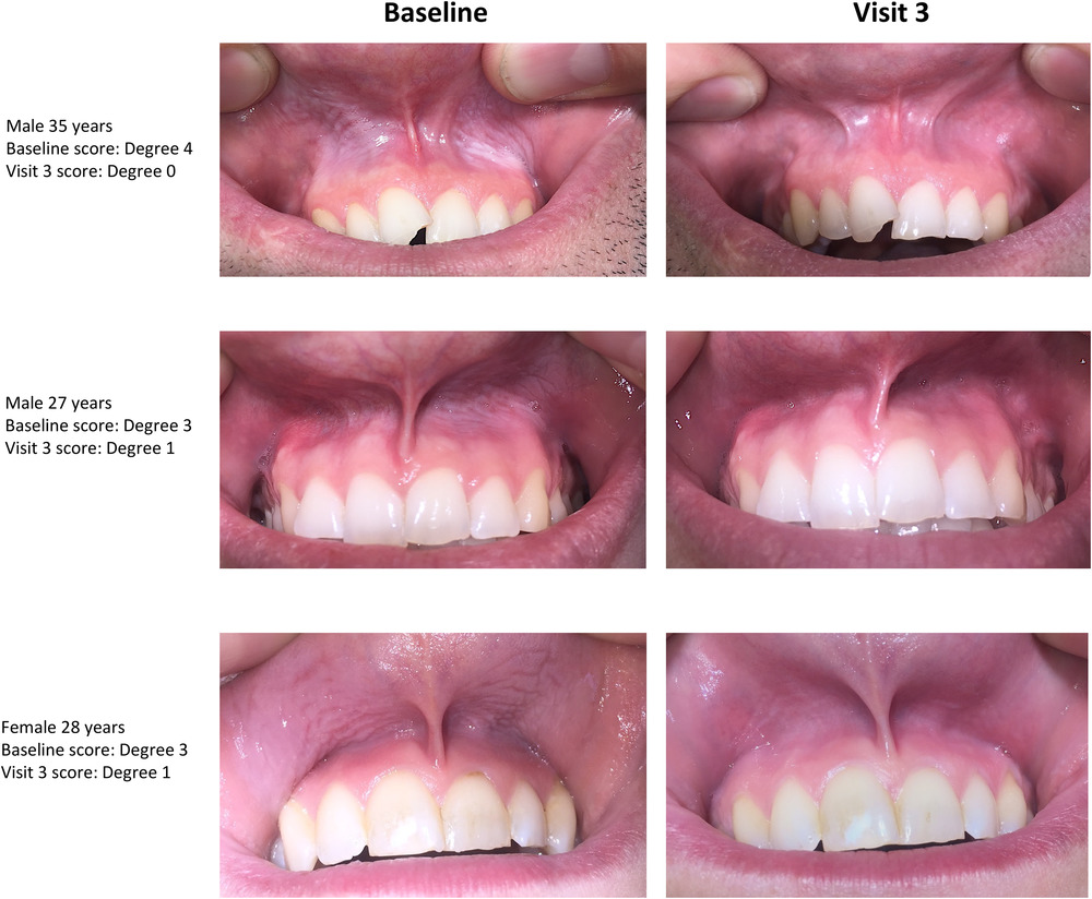 eos12885 fig 0004 m